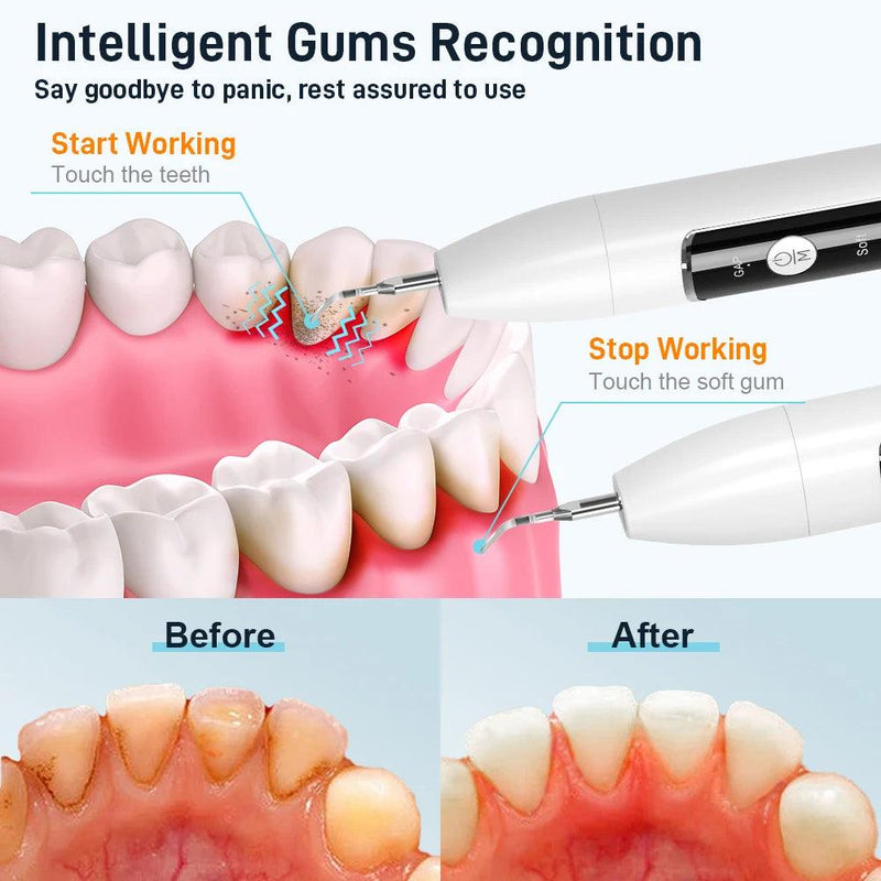 Schoben Scaler odontológico ultra-sônico com câmera, limpador de placas dentárias e tártaros