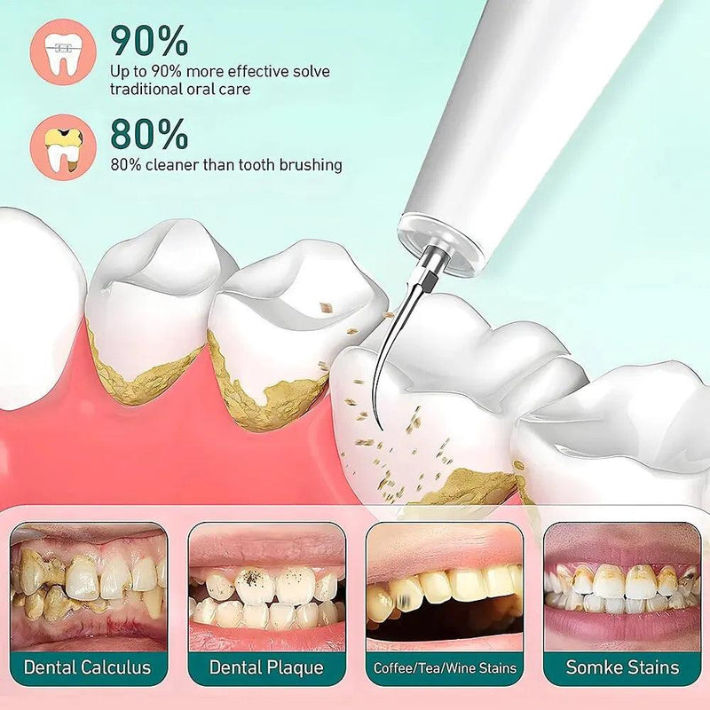 Removedor dental tártaro limpador dente